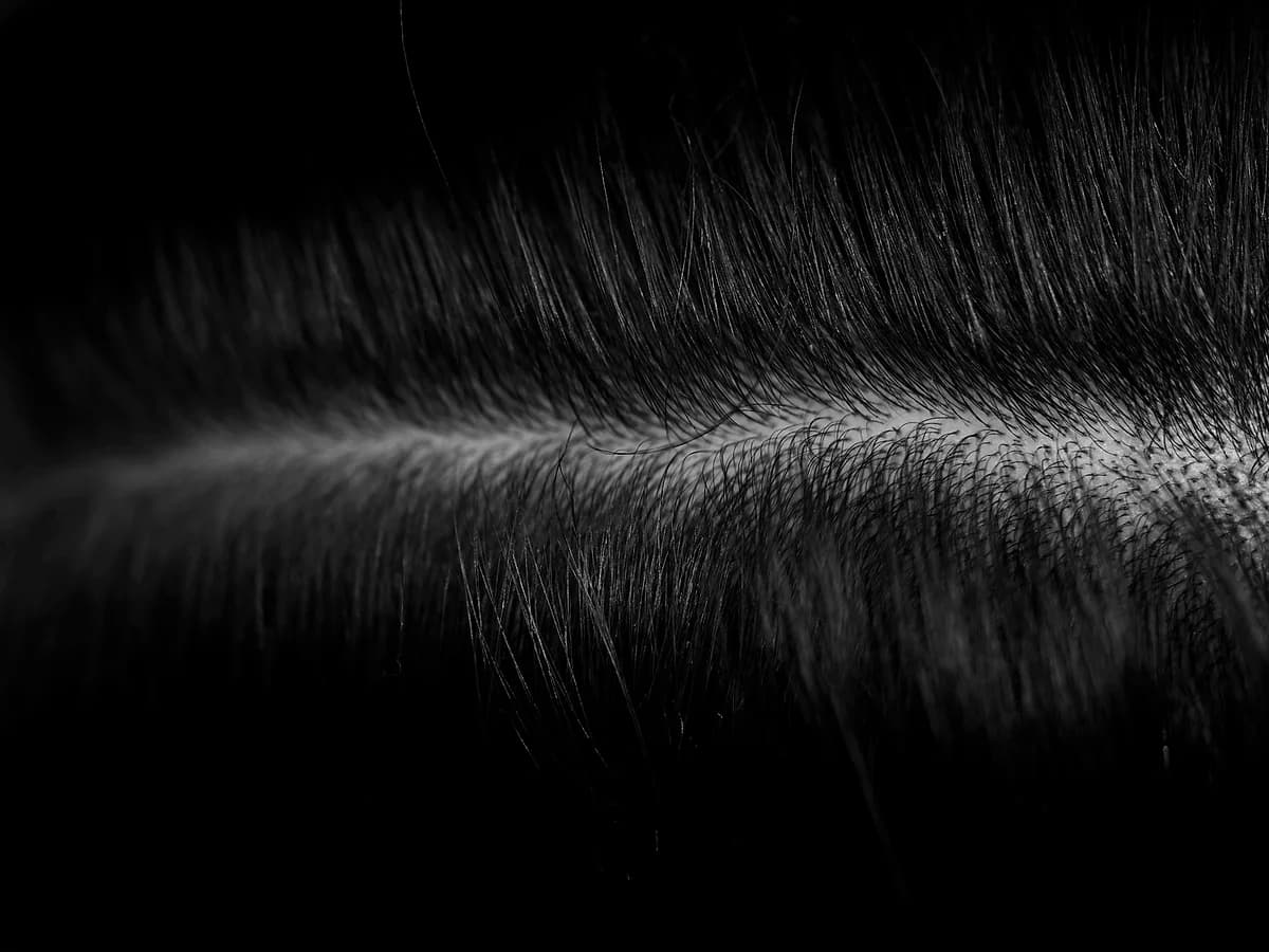 Scalp Micropigmentation (SMP)